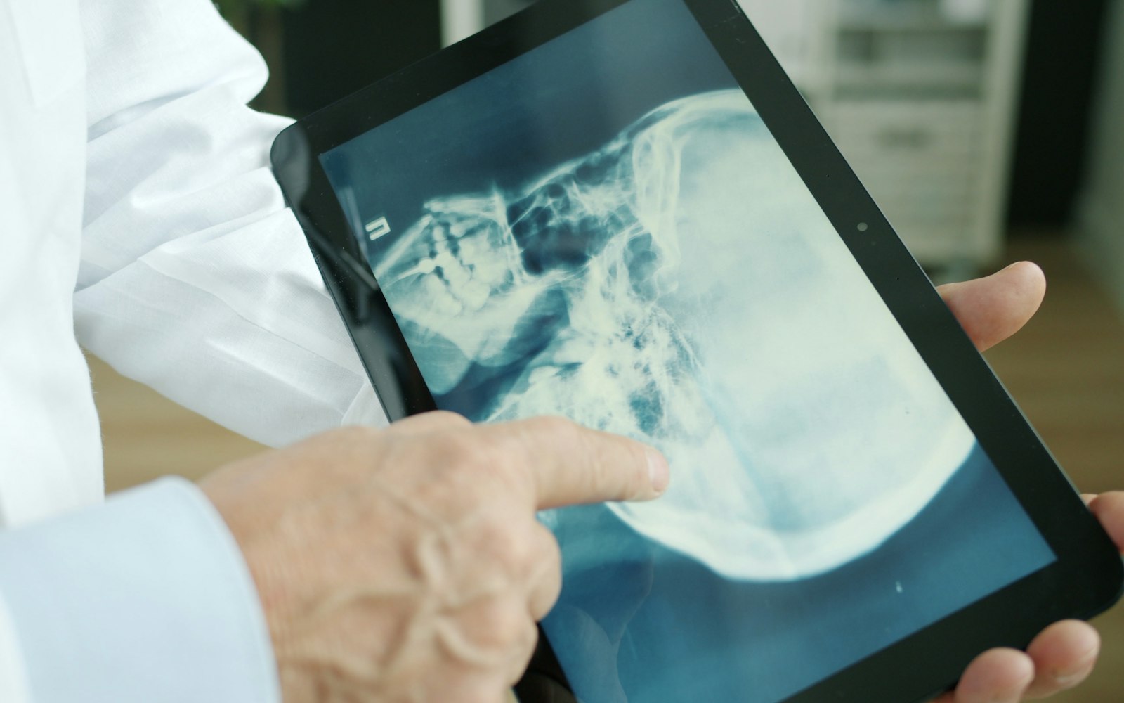 Gastroenterologist reviewing bile duct imaging for ERCP